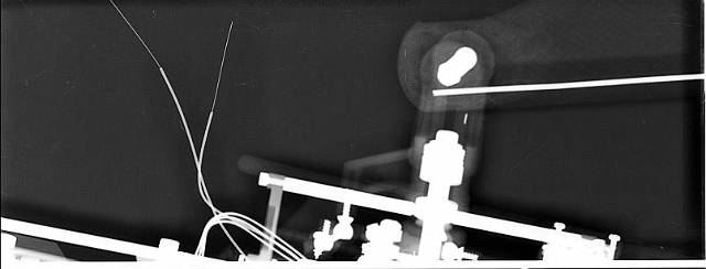Radiographie du HDX500SAS : pied de pale (petite inclusion m�tal).